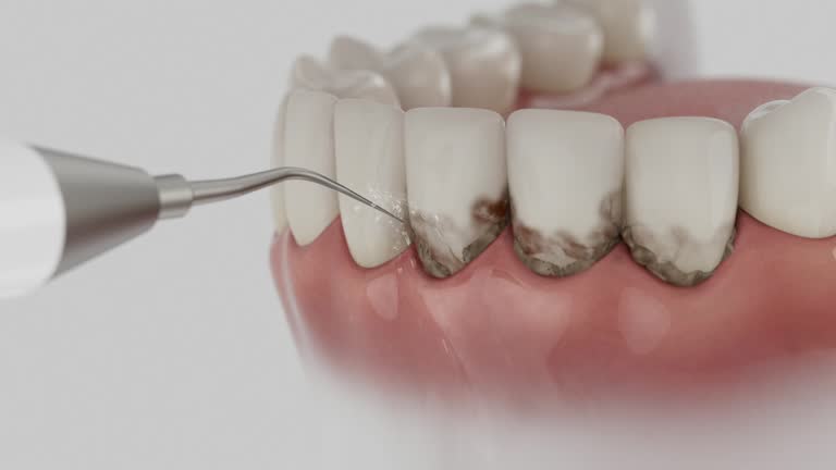 Reliable Dental Implants contractor in Milroy, PA by Smile Center Dentistry
